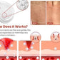 Skin Tag Remover Patch